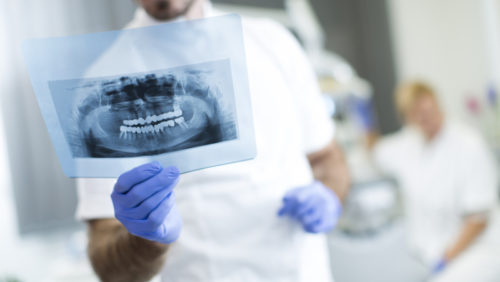 Co to jest ząb zatrzymany i jak go leczyć?